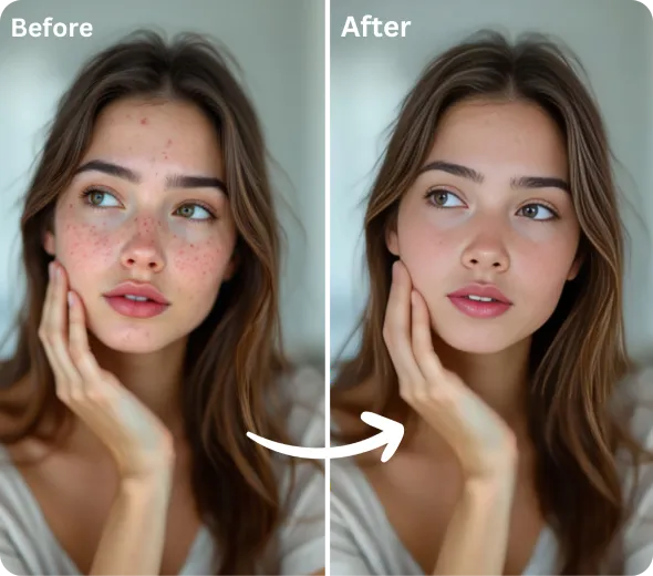 Enhance Your Portraits using AI Blemish Remover 